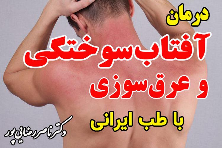  راههای درمان آفتاب سوختگی و عرق‌ سوزی از زبان پزشک متخصص طب ایرانی