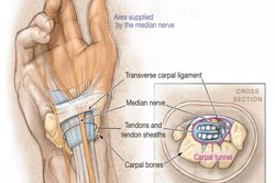 اثر درمان دستی ایرانی (تکنیک فاتح) بر بیماران مبتلا به سندرم تونل کارپ متوسط و خفیف