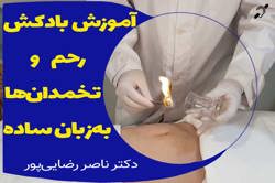آموزش ساده بادکش رحم و تخمدانها در منزل توسط متخصص طب ایرانی